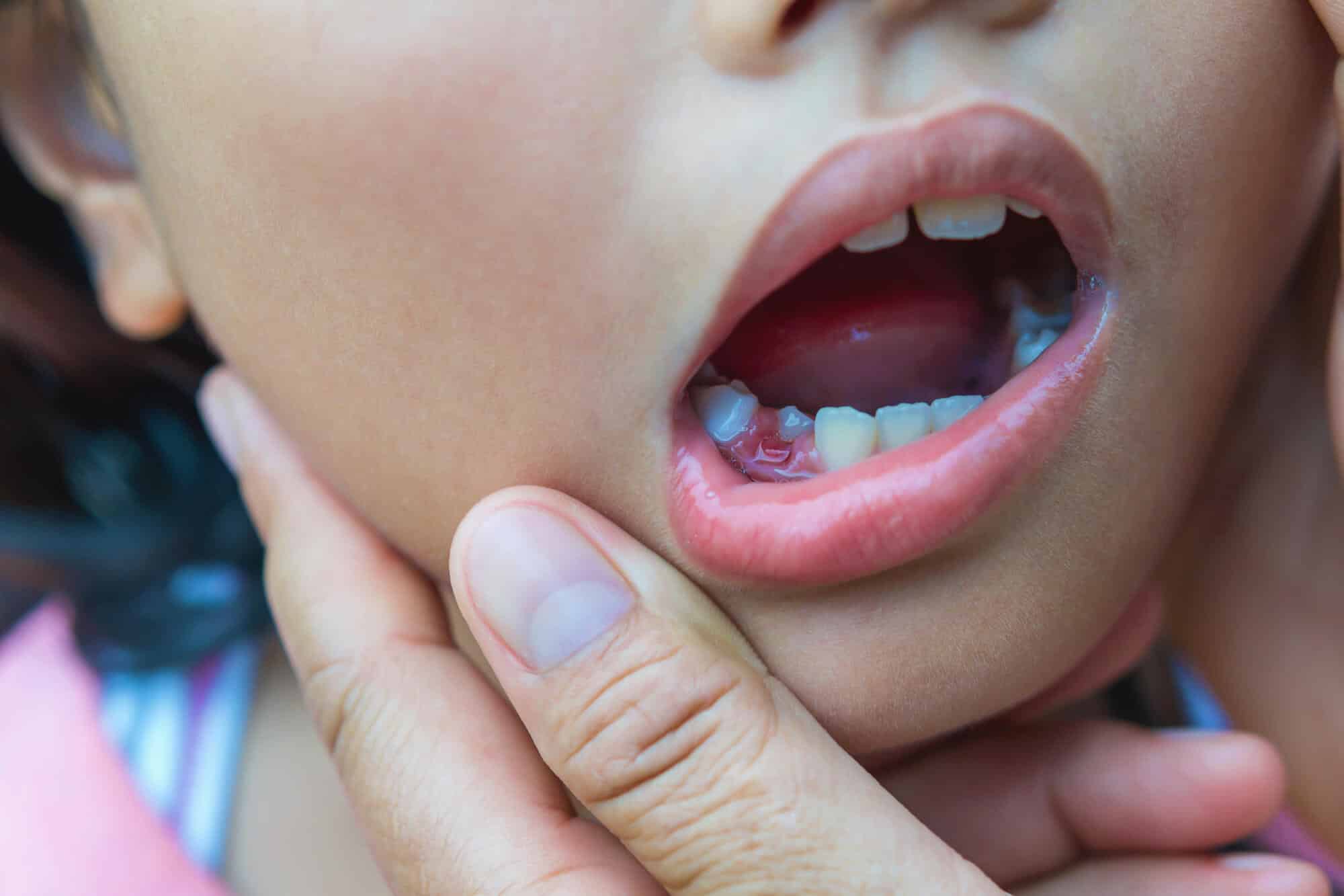 When Will My Baby Start Developing Teeth?