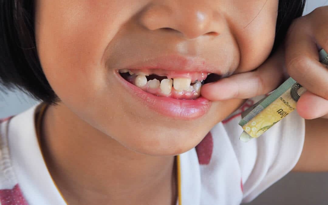 cavities in children