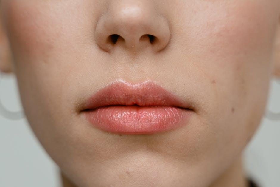 untreated lip tie
